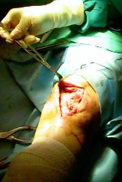 leftKnee.jpg (13730 bytes)